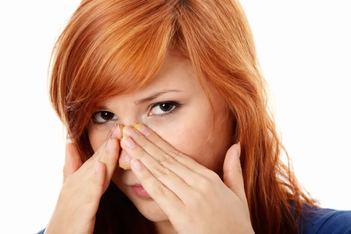 poppers croutes jaunes sur le nez